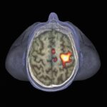 Brains React to Signs of Illness—Even When It’s Not Real