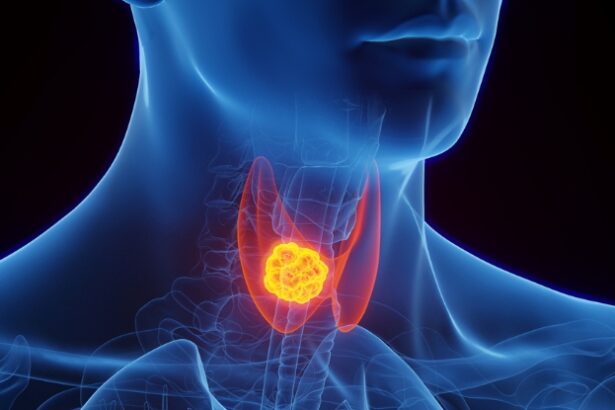 Concerns Emerge Over Potential Cancer Links to Drugs Like Ozempic : ScienceAlert