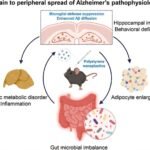 Exposure to nanoplastics could induce spread of Alzheimer’s disease from the brain to other organs
