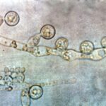 How the common fungus Candida albicans colonizes the gut
