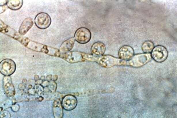 How the common fungus Candida albicans colonizes the gut