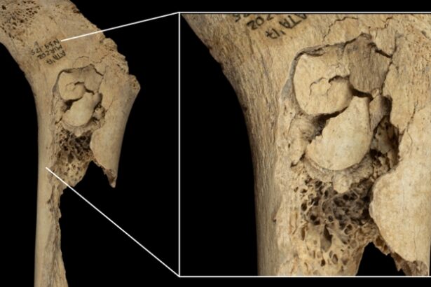 Human Bones Reveal Evidence of One Horrifying Cannibalistic Feast : ScienceAlert