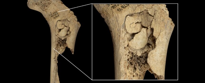 Human Bones Reveal Evidence of One Horrifying Cannibalistic Feast : ScienceAlert