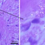 Microplastics Are Infiltrating Your Brain. What Are The Effects? : ScienceAlert