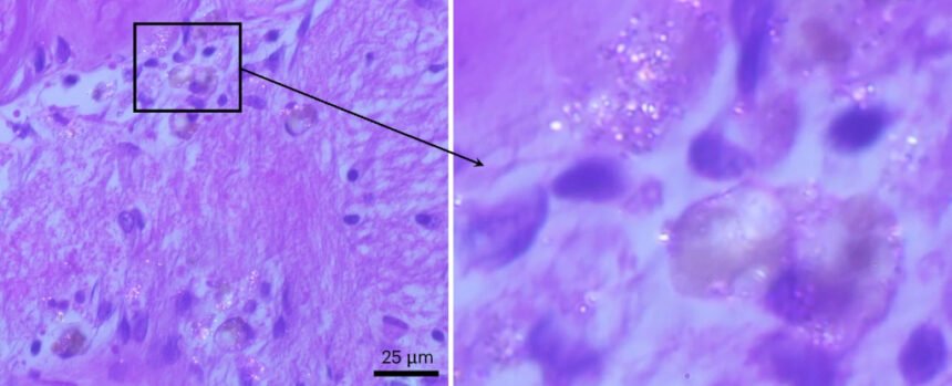 Microplastics Are Infiltrating Your Brain. What Are The Effects? : ScienceAlert