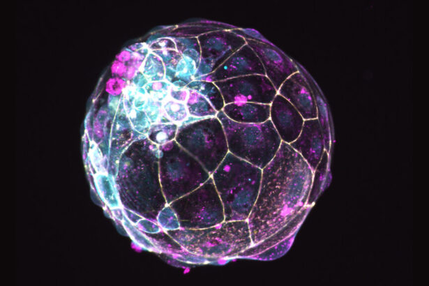 New guidelines call for stricter oversight of some stem cell-based research