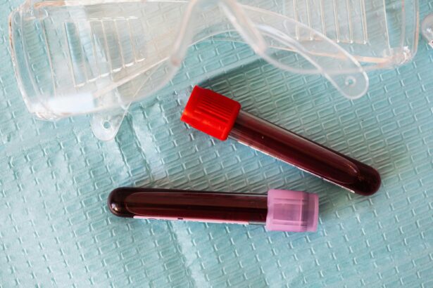 Prediabetes more life-threatening for people aged 20–54, study finds