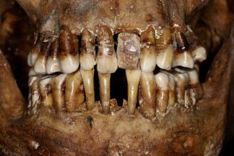 This 17th-Century Aristocrat Had a Clever Secret For Keeping Her Teeth : ScienceAlert