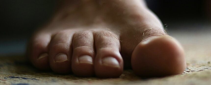 What Lives Between Your Toes? A Microbiologist Explains. : ScienceAlert