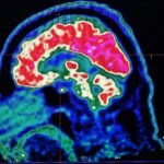 What are all these microplastics doing to our brains?