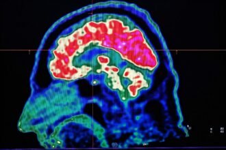 What are all these microplastics doing to our brains?