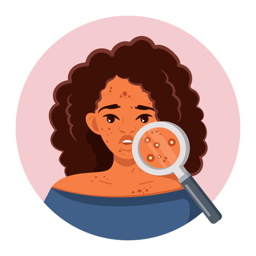 Things To Know About These Disorders