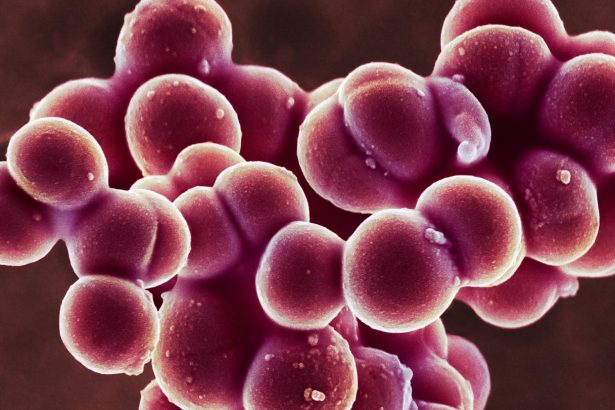 Staph bacteria are bad at letting go