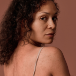 The Ultimate Guide To Caring For Ruddy Skin Without Overdoing It