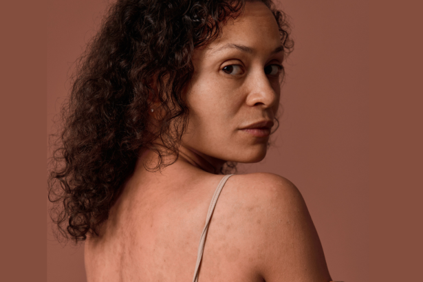 The Ultimate Guide To Caring For Ruddy Skin Without Overdoing It