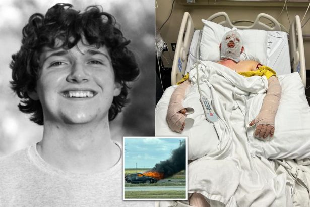 Texas college student, 19, suffers ‘catastrophic, life-changing’ burns after being struck by alleged drunk driver