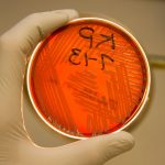 CDC Sounds Alarm over ‘Nightmare Bacteria’ That Resist Last-Resort Antibiotics