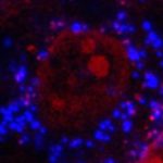 Microplastics linked to impaired bone health