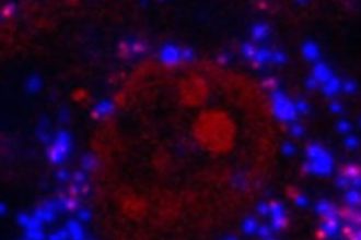 Microplastics linked to impaired bone health
