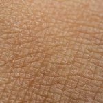 Stretching the skin could enable vaccines to be given without a needle