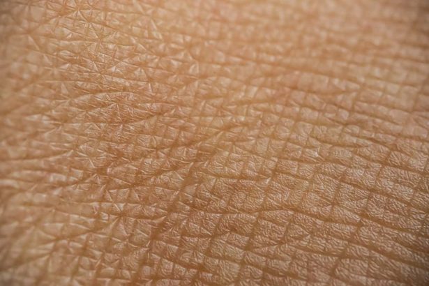 Stretching the skin could enable vaccines to be given without a needle