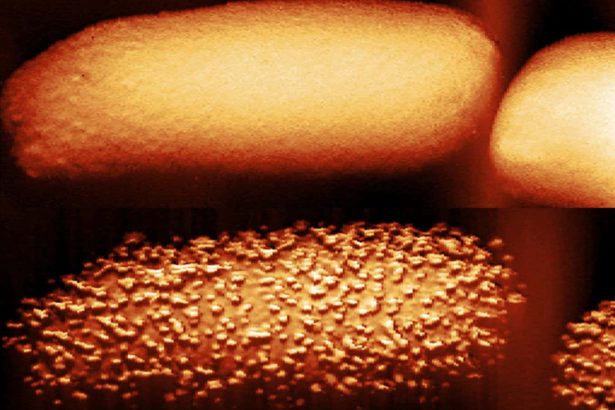 Extraordinary pictures show what a common antibiotic does to E. coli