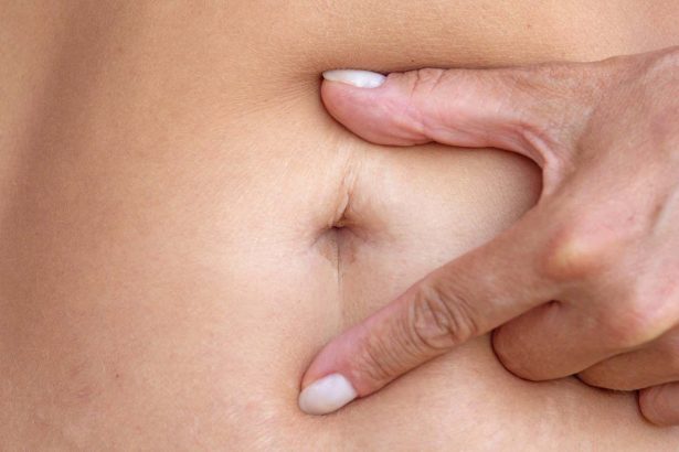 We now know why a belly button becomes an ‘innie’