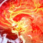 Stem Cells Repair Brain Damage Caused by Stroke in Mice : ScienceAlert