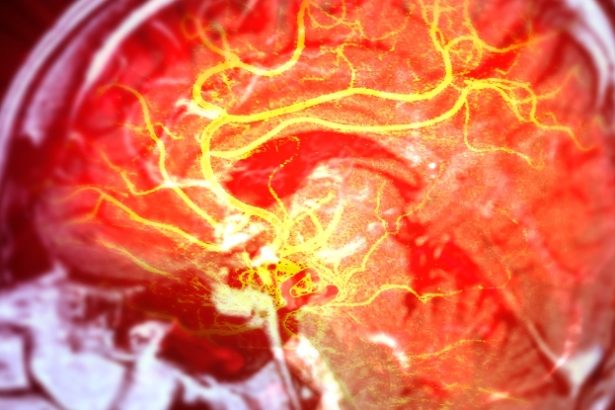 Stem Cells Repair Brain Damage Caused by Stroke in Mice : ScienceAlert