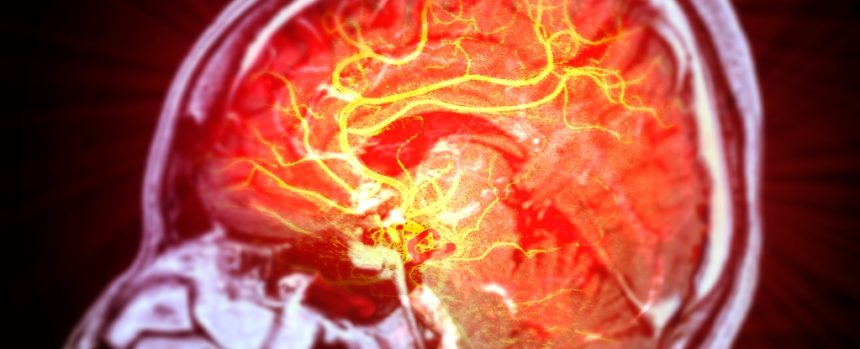 Stem Cells Repair Brain Damage Caused by Stroke in Mice : ScienceAlert