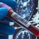 World Alzheimer’s Day: Here’s How Far We’ve Come in Search of a Cure