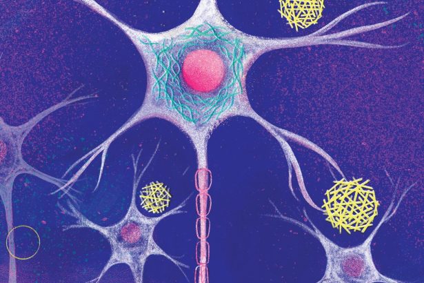 New Hope in Alzheimer’s Research: A Special Report