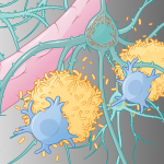 See How Alzheimer’s Disease Works—And How the Newest Treatments Fight It