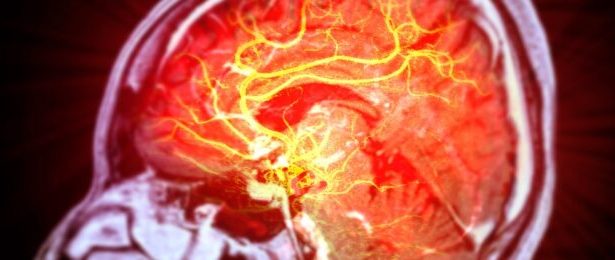 Stem Cells Repair Brain Damage Caused by Stroke in Mice