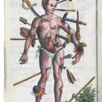 How the Wound Man Healed Medieval Europe 