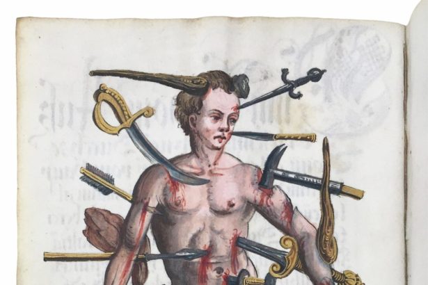How the Wound Man Healed Medieval Europe 
