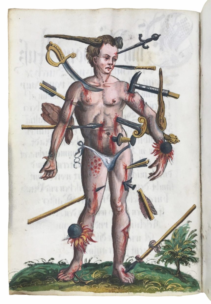 How the Wound Man Healed Medieval Europe 