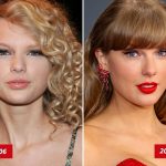 Taylor Swift Good Genes or Good Docs?!
