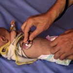 An estimated 54,600 young children are malnourished in Gaza