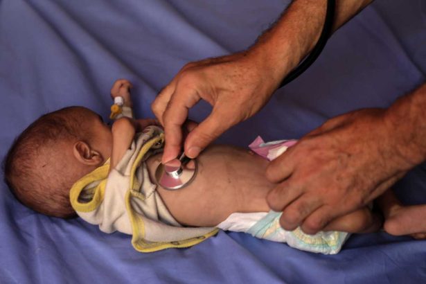 An estimated 54,600 young children are malnourished in Gaza