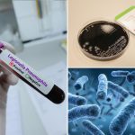NYC Council approves bill to boost testing for Legionnaires’ disease in cooling towers