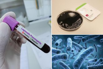 NYC Council approves bill to boost testing for Legionnaires’ disease in cooling towers