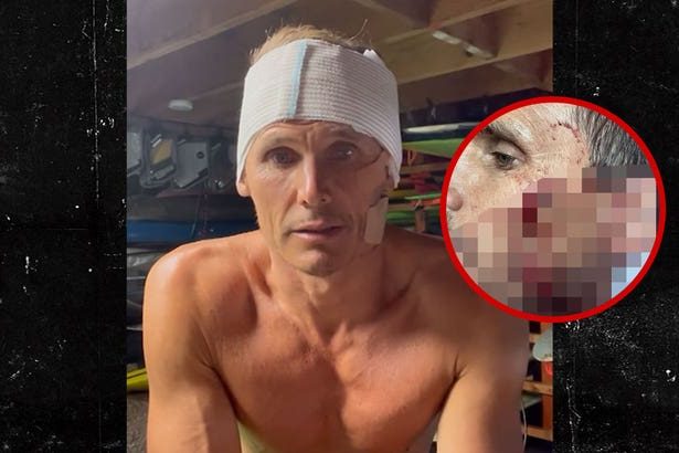 Surfer Jamie Mitchell Suffers Gruesome Cuts in Freak Wipeout