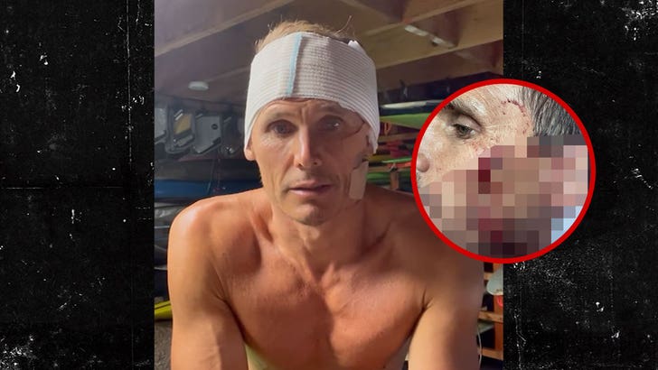 Surfer Jamie Mitchell Suffers Gruesome Cuts in Freak Wipeout