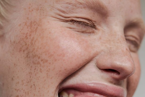 I Do Oil Pulling Every Morning—Here Are the Benefits