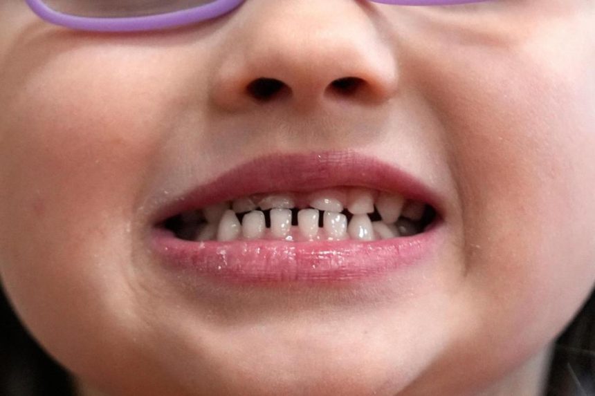 FDA restricts use of kids’ fluoride supplements FDA restricts use of kids’ fluoride supplements