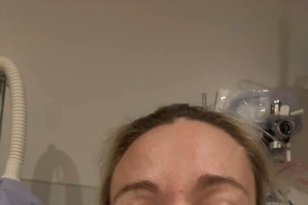 Kate Gosselin Details Brutal Recovery After ‘Life-Altering’ Injury