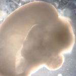 How brain organoids are revealing what truly makes humans unique