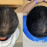 Serum based on plant extracts boosts hair growth in weeks