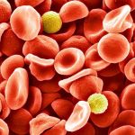 Scientists Identified a New Blood Group After a 50-Year Mystery : ScienceAlert Scientists Identified a New Blood Group After a 50-Year Mystery : ScienceAlert